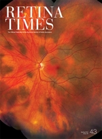 Retina Times