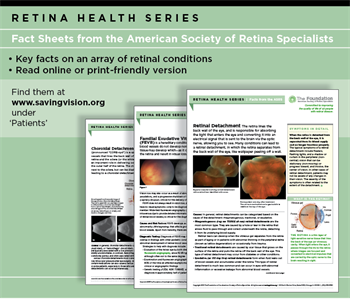 Retina Problem Posters Retinal diseases - The American Society of Retina Specialists