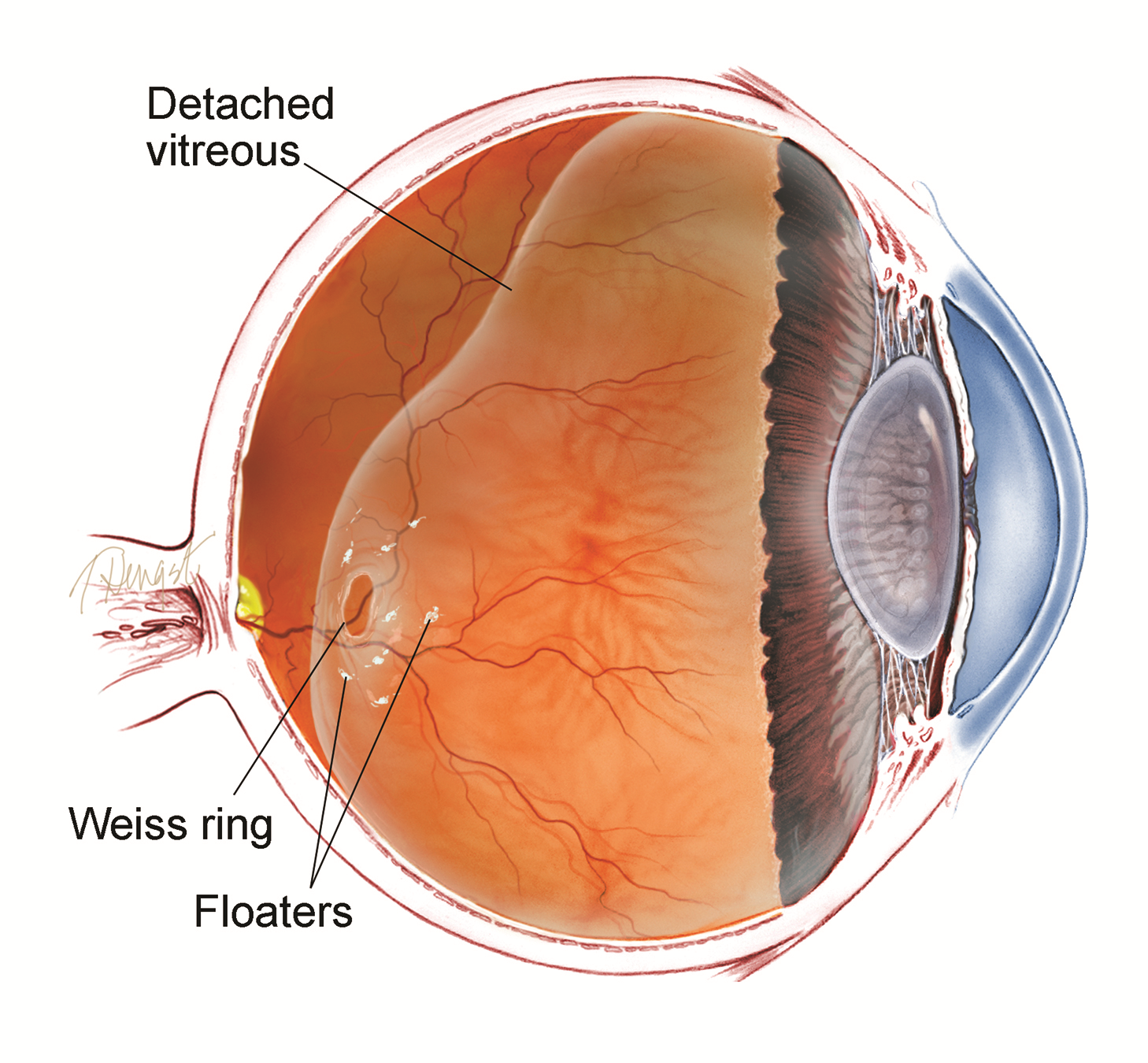 Scale Model Of Human Eye