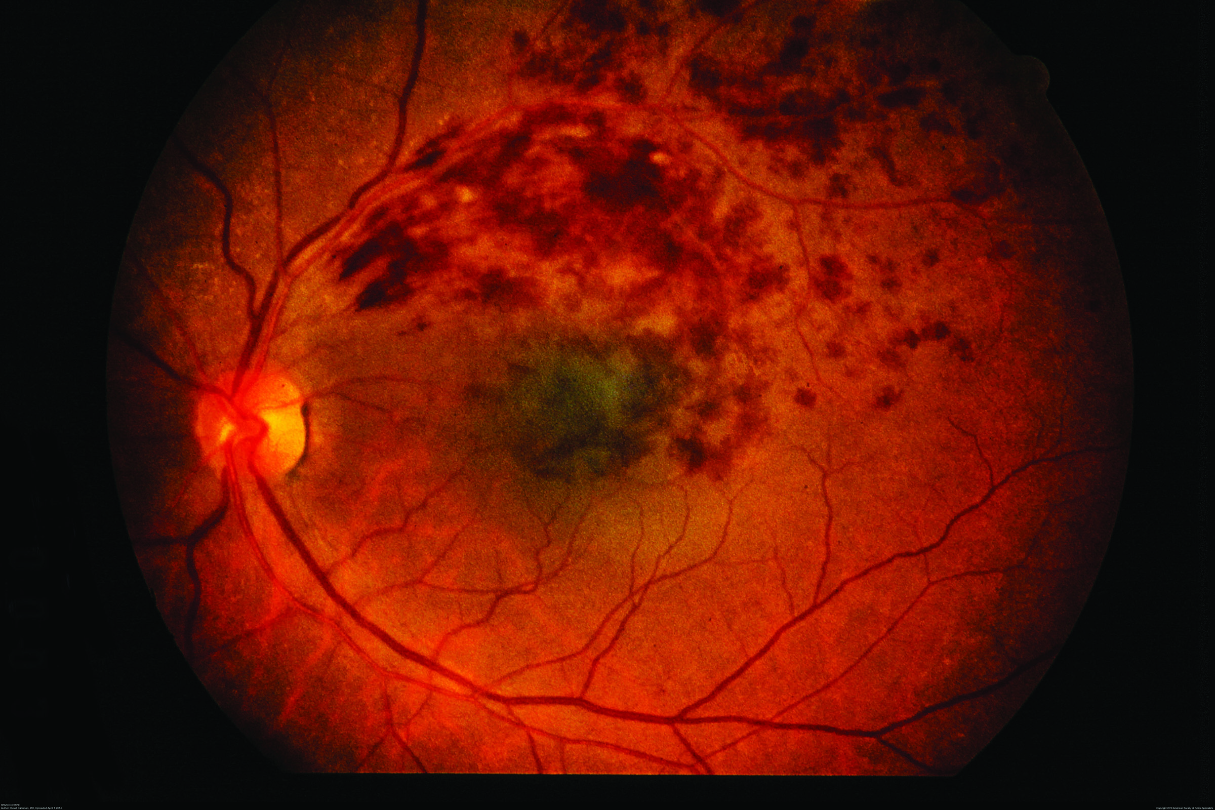 texas retina associates hours texas retina associates hours