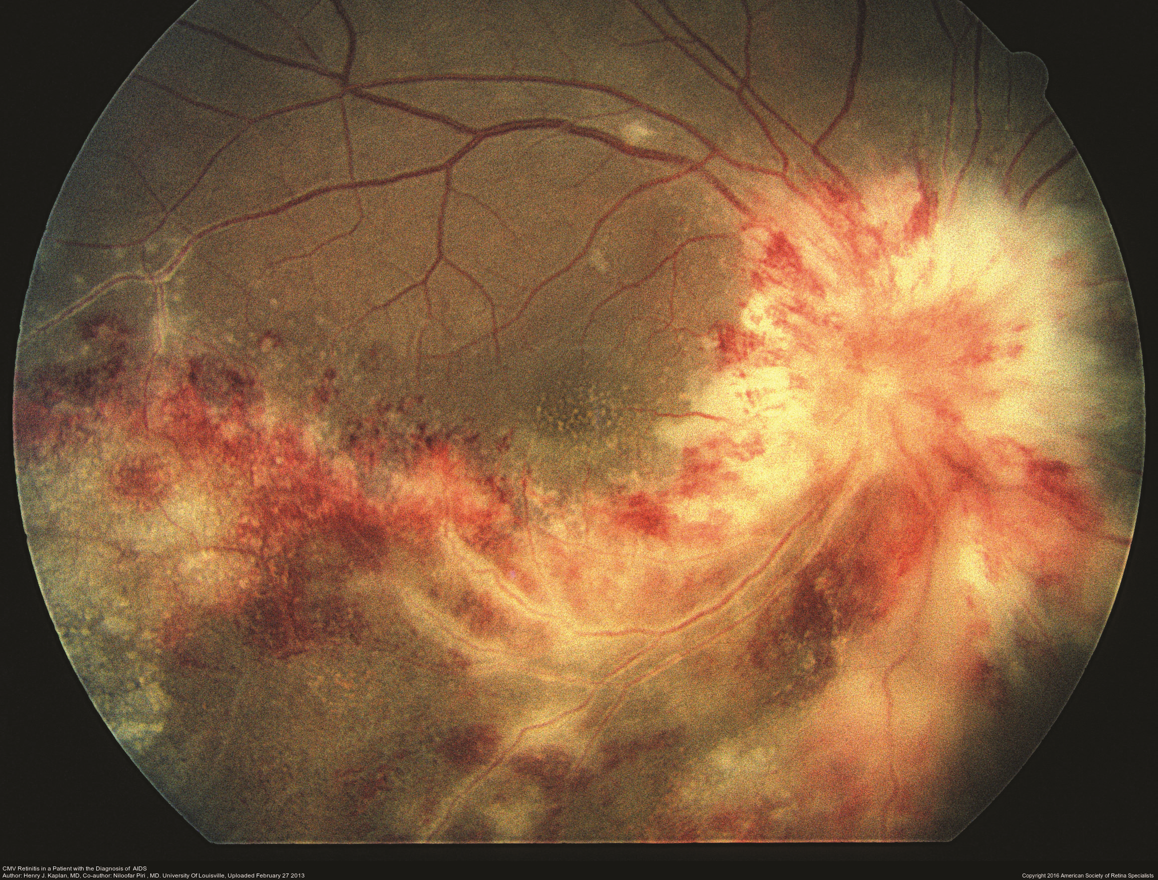 eye specialist eye specialist for retinal disease hairsstyles co eye specialist eye specialist for retinal disease hairsstyles co