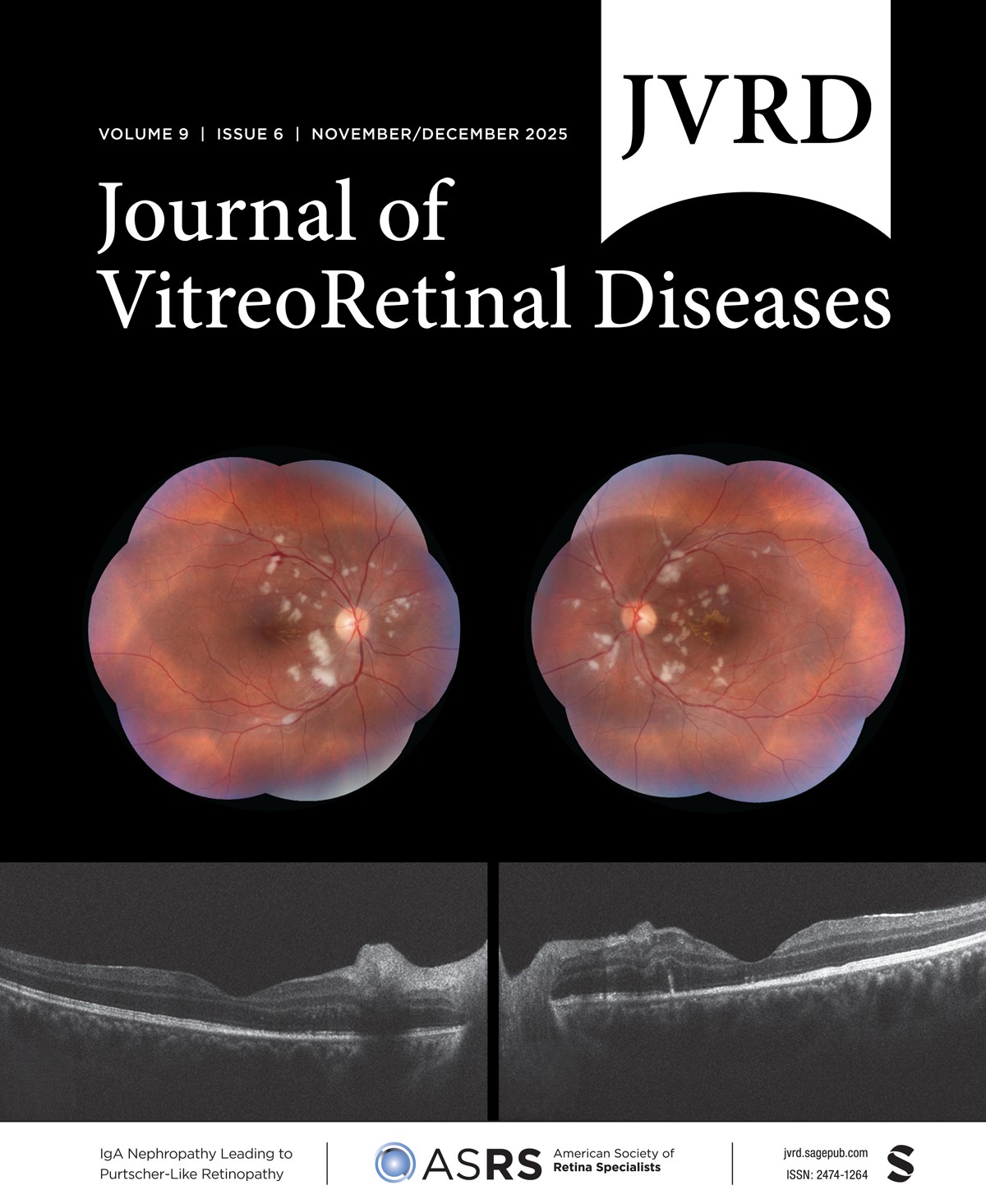 Journal of Vitreoretinal Diseases