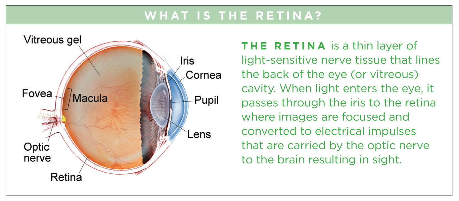 detached retina symptoms pictures detached retina symptoms pictures