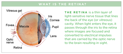 Can You Prevent and Treat Retinal Detachment?