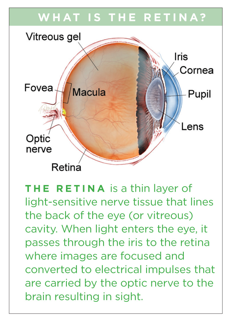 hole in eye retina hole in eye retina