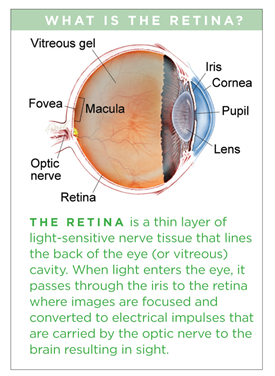 retinal edema definition