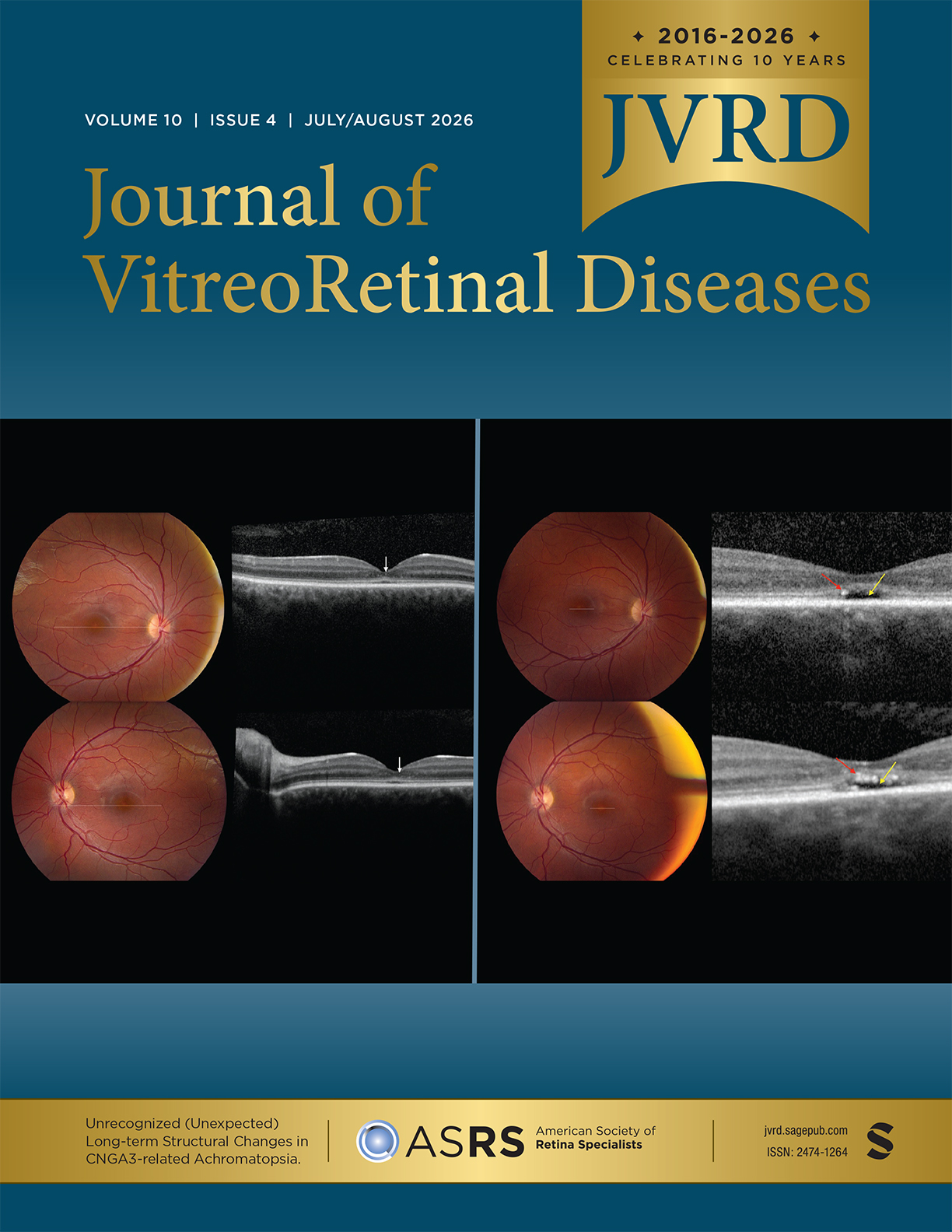 Journal of Vitreoretinal Diseases