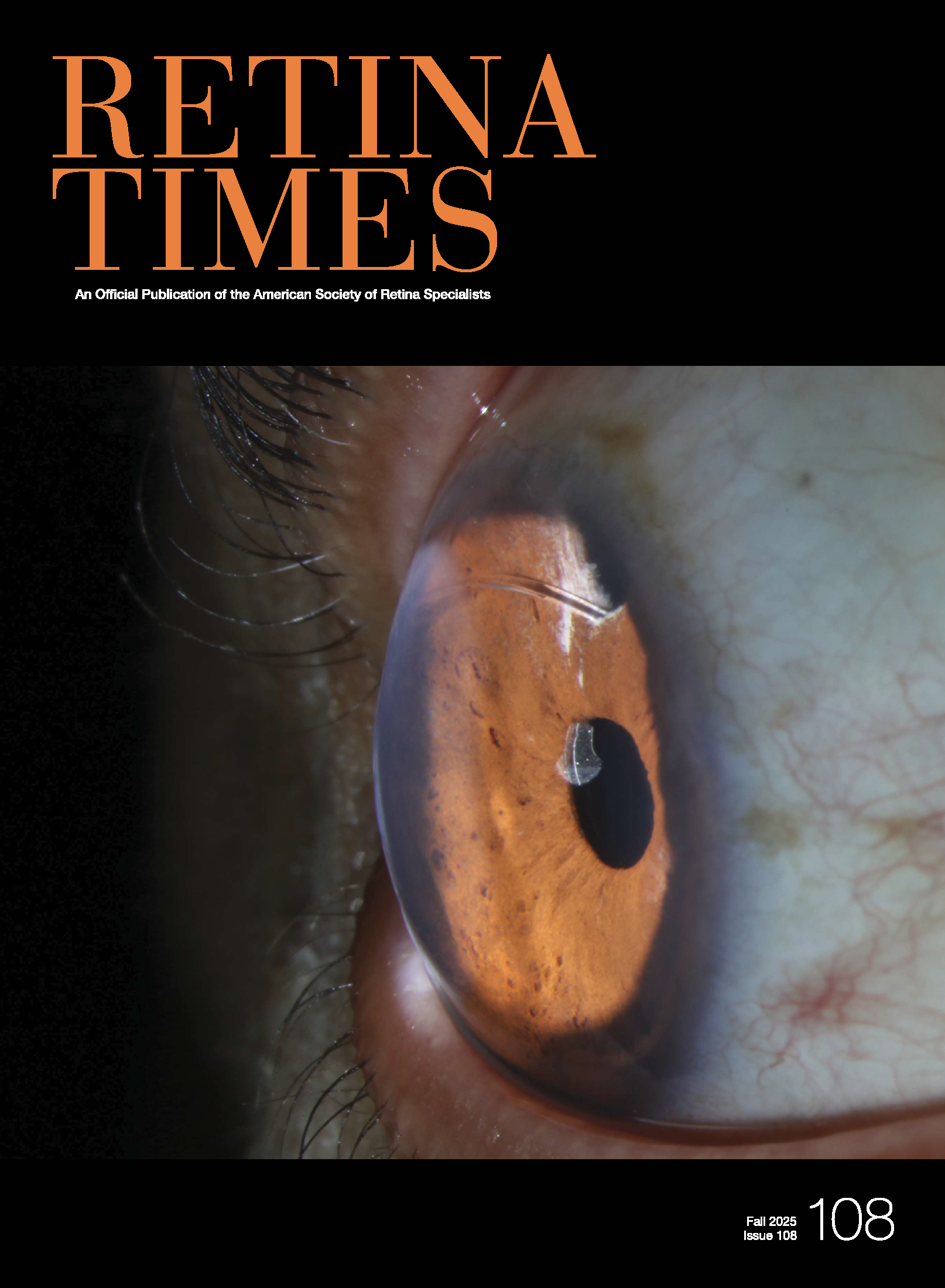 Retina Times
